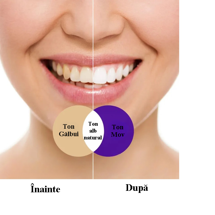 Pastă pentru Albirea Dinților V34 HYSMILE