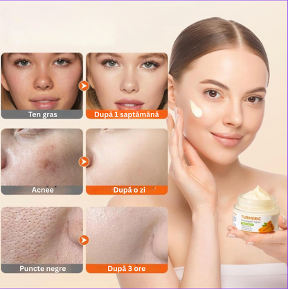 Crema de față cu Turmeric și vitamina C, cremă hidratantă pentru acnee, pete, anti-rid, zi și noapte, fermitate și netezire, uniformizează nuanța tenului — 50g