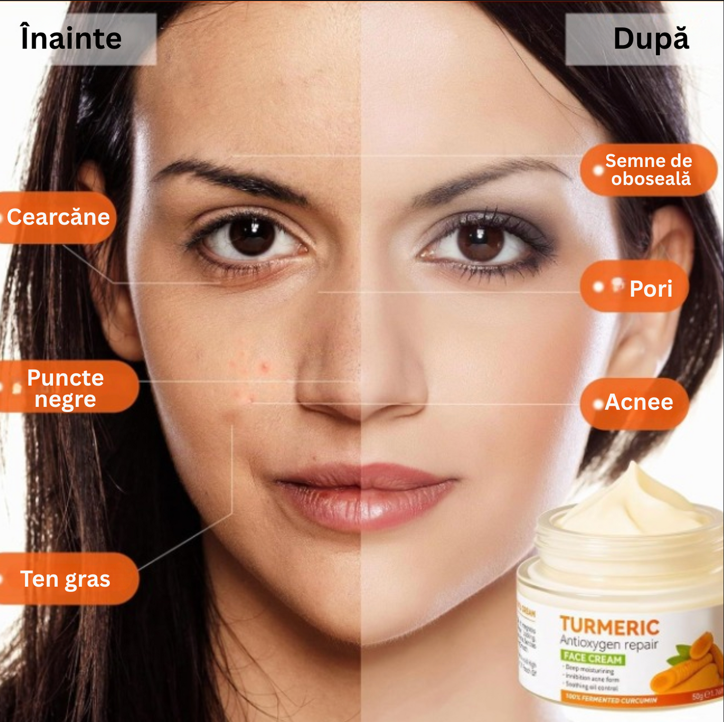 Crema de față cu Turmeric și vitamina C, cremă hidratantă pentru acnee, pete, anti-rid, zi și noapte, fermitate și netezire, uniformizează nuanța tenului — 50g