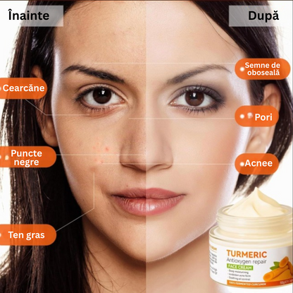 Crema de față cu Turmeric și vitamina C, cremă hidratantă pentru acnee, pete, anti-rid, zi și noapte, fermitate și netezire, uniformizează nuanța tenului — 50g